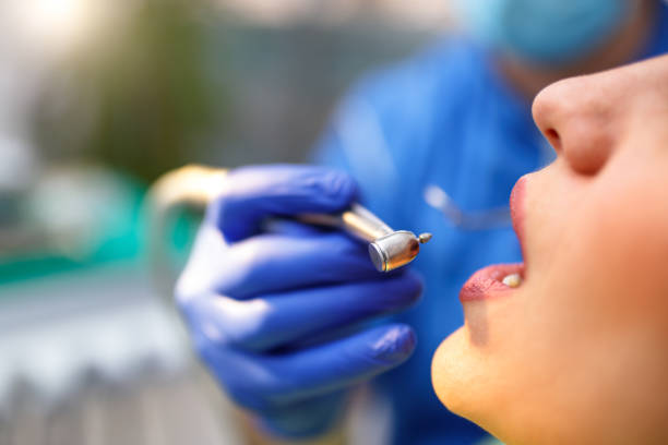 Dental Bonding in Lake Holiday, IL
